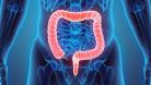 Cura de 7 zile pentru intestine sanatoase - adio grasime, toxine si cancer de colon