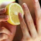 Top 5 remedii naturale pentru unghiile ingalbenite